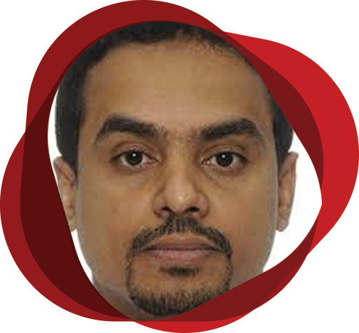 Rare but Real: Uncommon Complications in Sickle Cell Disease and Their Management